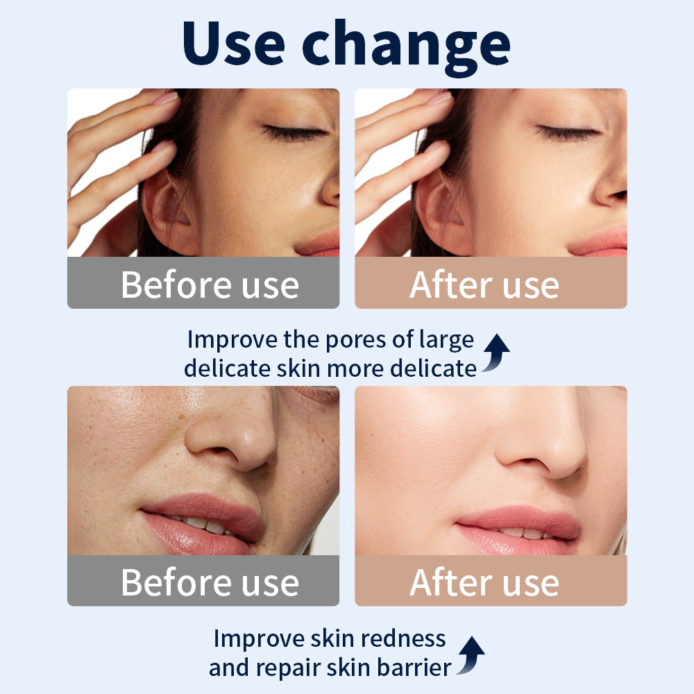 LED Light Therapy Face Mask