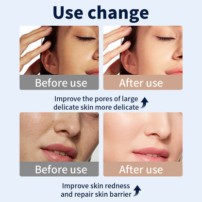 LED Light Therapy Face Mask