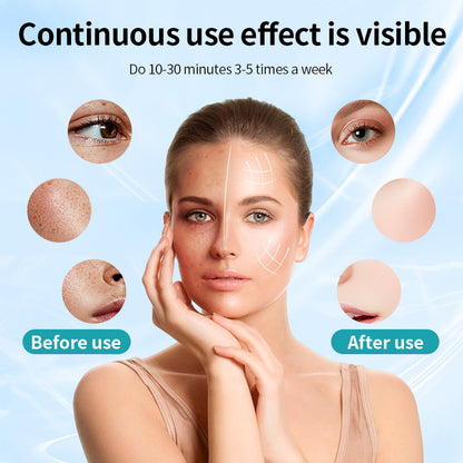 LED Light Therapy Face Mask